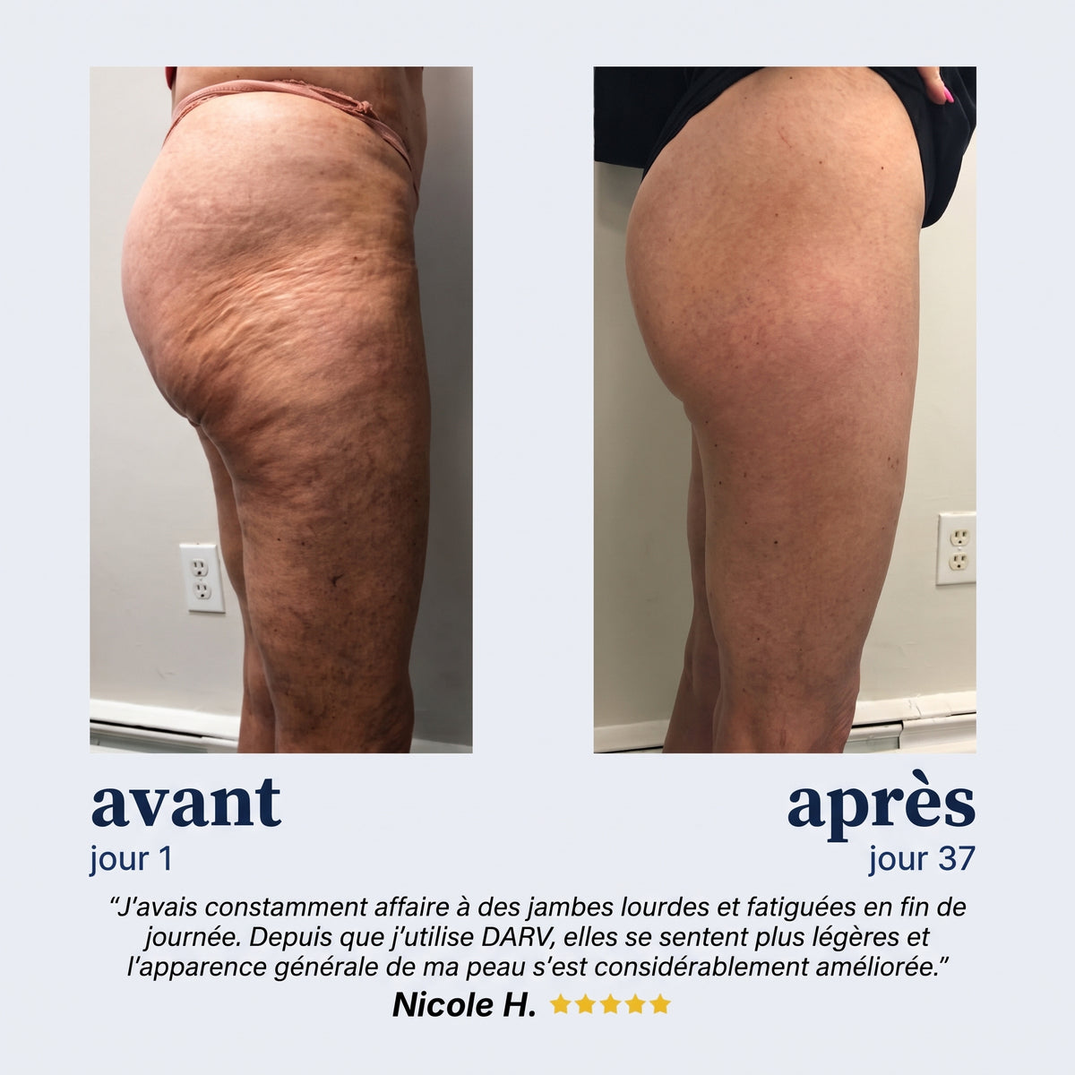 DARV Anti-Cellulite Pro : L’Expert Minceur 4-en-1 (Livraison offerte)
